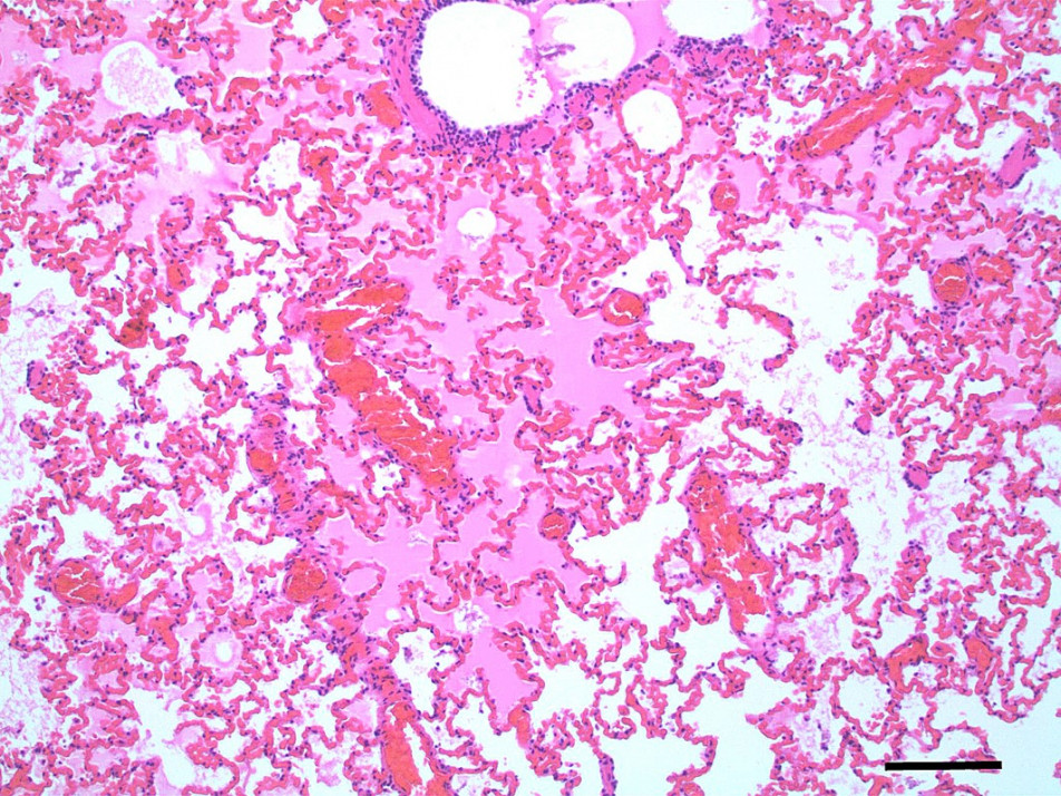Lung histopathology